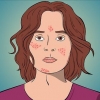 Rimedio dell'acne con formazione di cisti