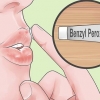 Tratta rapidamente l'acne intorno alle labbra