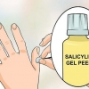 Sbarazzati delle verruche sulle dita