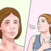 Trattare le allergie