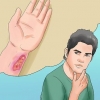 Prevenire il botulismo