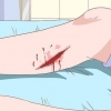 Trattare la cellulite