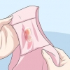Riconoscere i sintomi della clamidia (per le donne)
