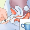 Trattare una vagina secca