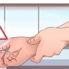Trattare un attacco di gotta