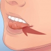 Perdere un dente sciolto senza tirarlo