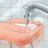 Inserimento di un pessario