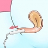 Rimuovere un tampone