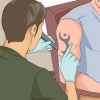 Rimuovi un tatuaggio