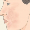 Cura la pelle troppo esfoliata