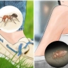 Riconosci le punture di insetti