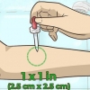 Sbiancamento dei peli del corpo