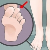 Affrontare il piede greco (sindrome di morton)