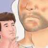 Trattamento dell'eczema seborroico sul viso
