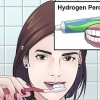Sbiancamento dei denti con perossido di idrogeno