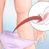 Prevenire il sanguinamento vaginale durante la gravidanza