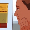 Sbarazzati di un brufolo con il gel di aloe vera