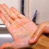 Rimuovi il colorante alimentare dalla pelle