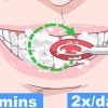 Impedire che una carie nei tuoi denti peggiori