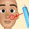 Crea il tuo trattamento per l'acne