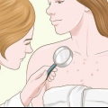 Sbarazzati delle cicatrici da acne sul petto