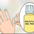 Sbarazzati delle verruche sulle dita