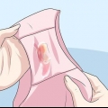 Riconoscere i sintomi della clamidia (per le donne)