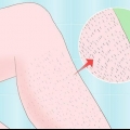 Rimuovere i peli spessi delle gambe