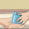 Trattamento dell'eczema disidrotico