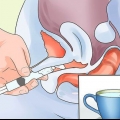 Trattare una vagina secca