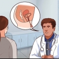 Inserimento di un catetere
