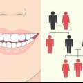 Correggi un sorriso storto