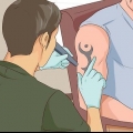 Rimuovi un tatuaggio