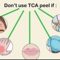 Applicazione di un peeling tca