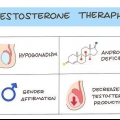 Dare un'iniezione di testosterone