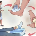 Primo soccorso per una distorsione