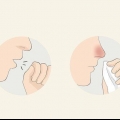 Riconoscere il coronavirus