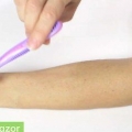 Diradare i capelli sulle braccia