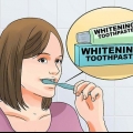 Sbianca i denti quando hai l'apparecchio