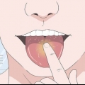 Cura la tua lingua dopo aver mangiato dolci