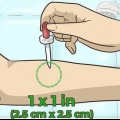 Sbiancamento dei peli del corpo