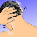 Usando rogaine o minoxidil