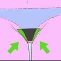 Rimuovere i peli pubici intorno alla vagina