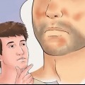 Trattamento dell'eczema seborroico sul viso
