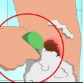Sbarazzati rapidamente delle croste dell'acne
