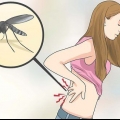 Alleviare il dolore muscolare di chikungunya