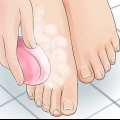 Prevenire i piedi puzzolenti