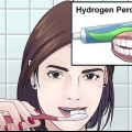 Sbiancamento dei denti con perossido di idrogeno