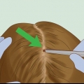 Togliersi le zecche dai capelli