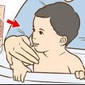 Trattare un'eruzione cutanea sul collo del tuo bambino